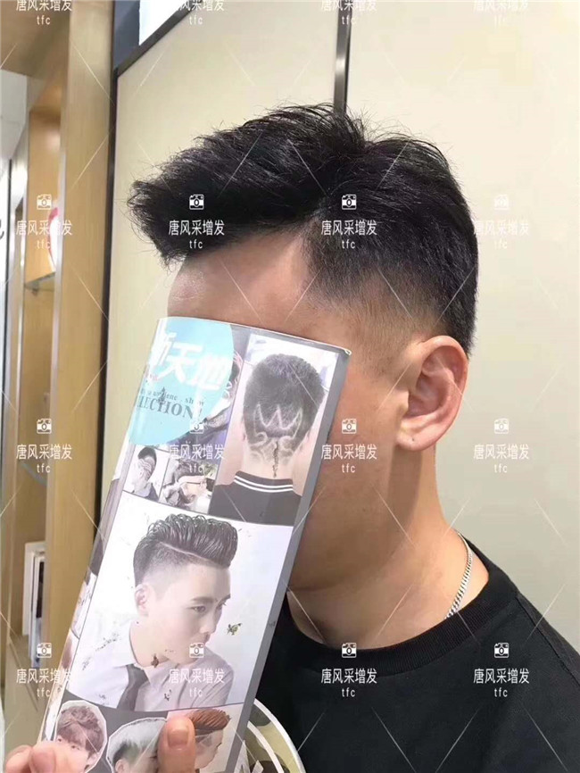 謝頂男人 在唐風采增發(fā)后