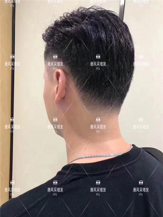謝頂男人 在唐風采增發(fā)后