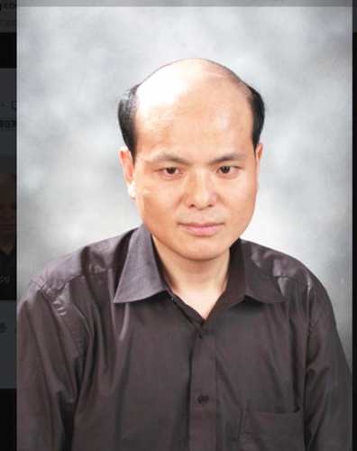 創(chuàng)始人唐利民 無(wú)痕增發(fā) 典型的脂溢性脫發(fā)