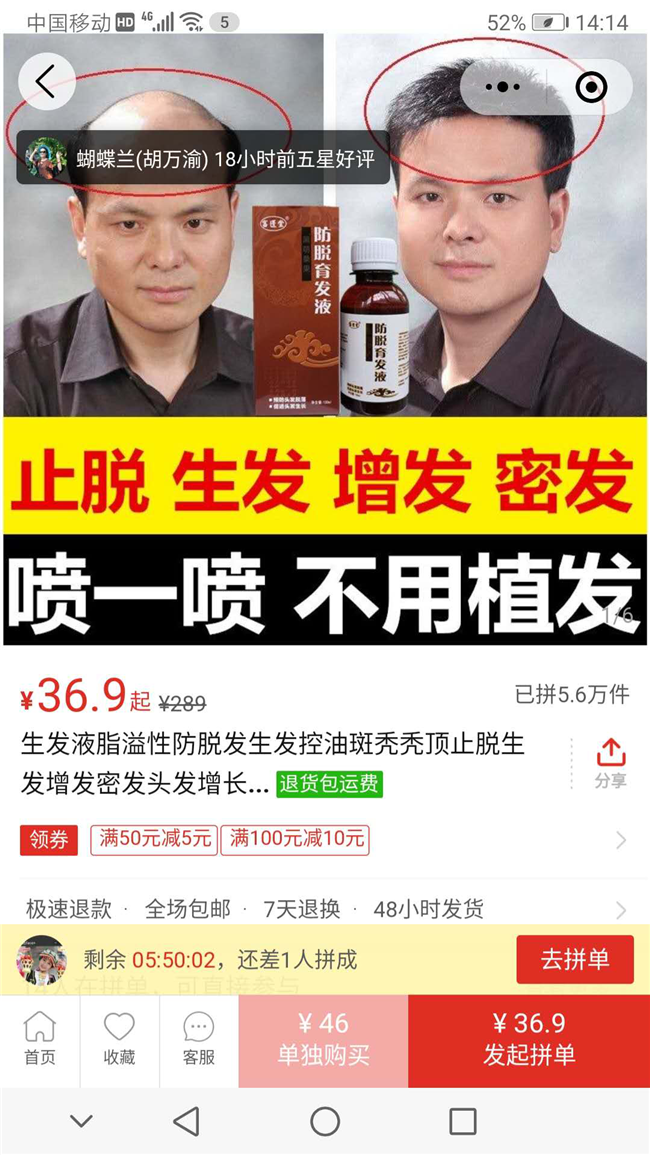 某品牌生發(fā)液。