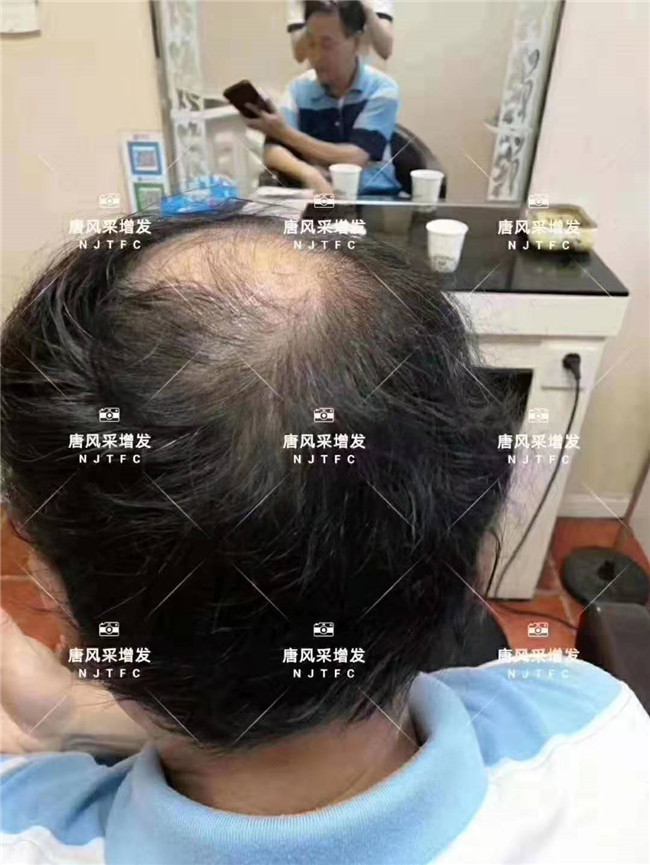“地方支援中央”政策。
