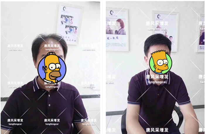 男老師戴假發(fā) 無痕假發(fā)