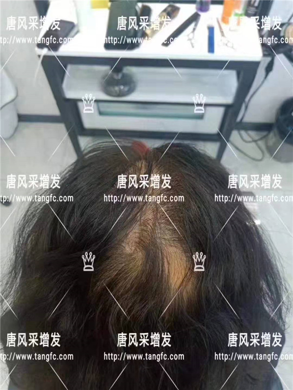 時尚假發(fā) 官方二維碼 唐風采無痕假發(fā)