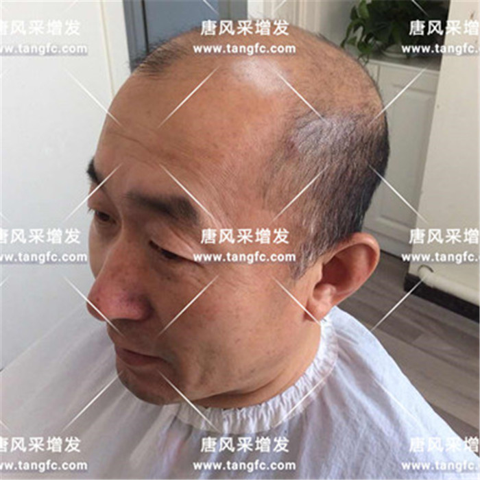 生發(fā)增發(fā) 唐風(fēng)采客戶案例