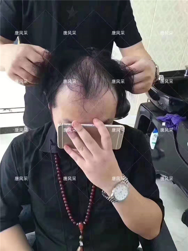 無痕真發(fā)發(fā)套 唐風采客戶案例