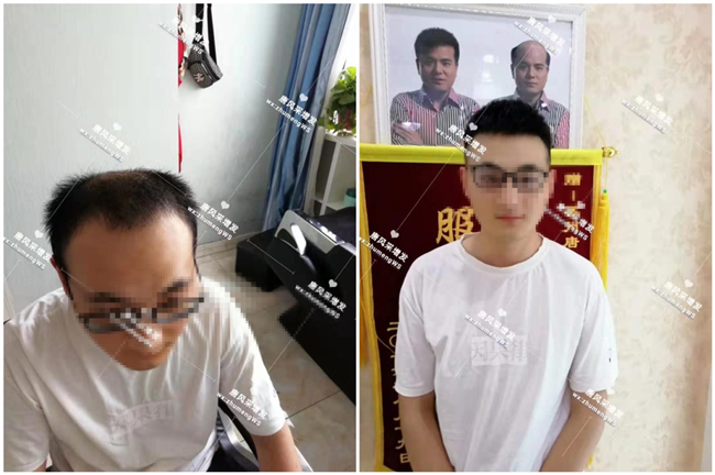 頭頂局部假發(fā) 唐風采假發(fā)可以戴著打球和游泳