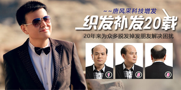 補(bǔ)發(fā)織發(fā)效果如何 唐風(fēng)采織發(fā)補(bǔ)發(fā)