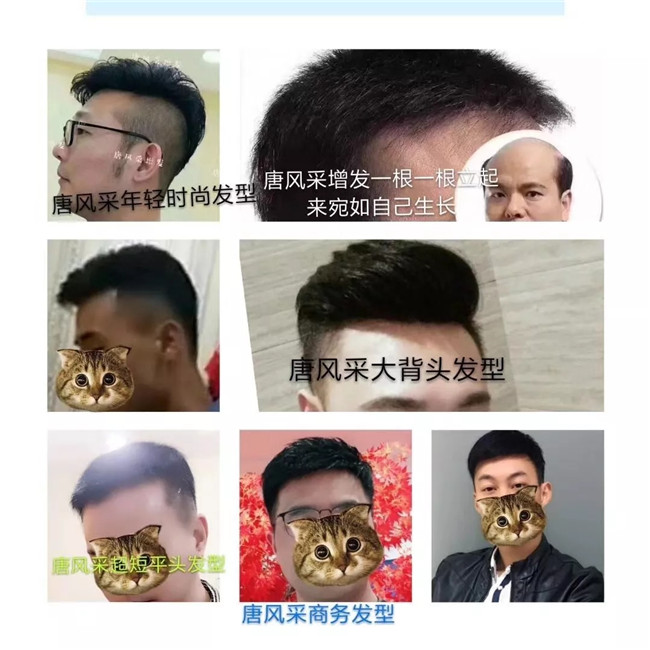 唐風采福州店 真實客戶案例分享篇照