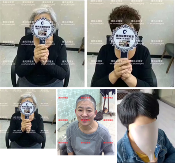 唐風采開展“關(guān)愛中老年健康”公益活動 唐風采活客戶案例——白頭發(fā)