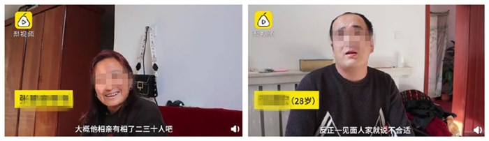 謝頂 原因竟然是脫發(fā)