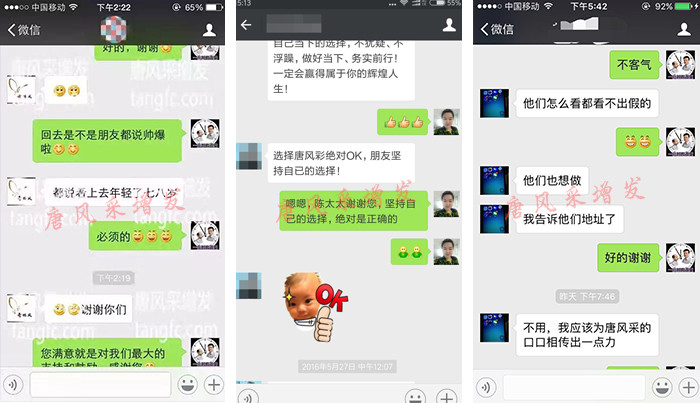 頭頂假發(fā)片 唐風采增發(fā)讓你變回自信