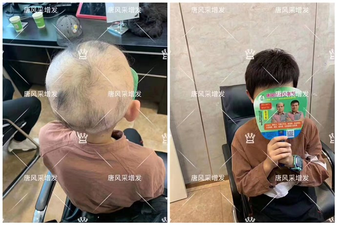 可以選擇到唐風(fēng)采購(gòu)買假發(fā)