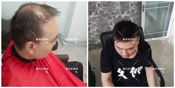 男老年假發(fā)套 唐風(fēng)采客戶案例