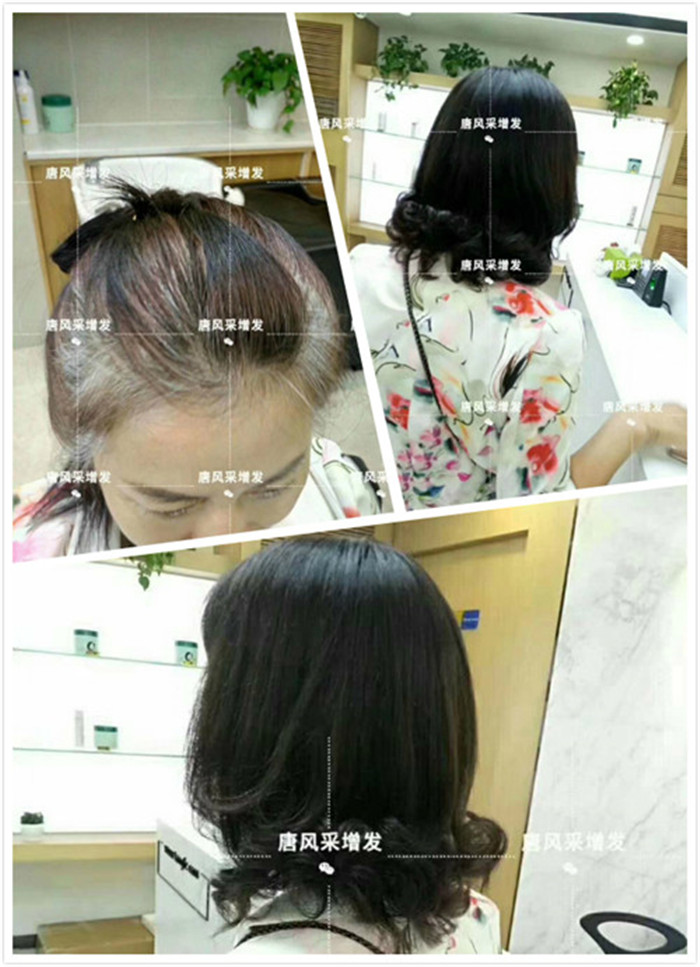 女人假發(fā) 唐風(fēng)采客戶陳女士