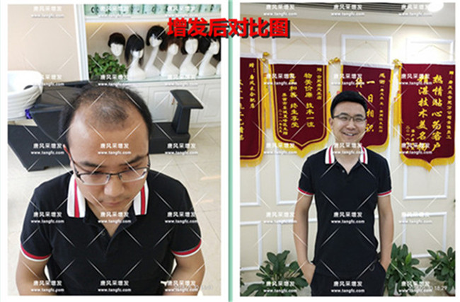 品牌真人假發(fā) 唐風(fēng)采客戶案例