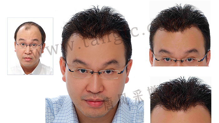 如果你hold不住謝頂，可以來試試真人頭發(fā)的假發(fā)