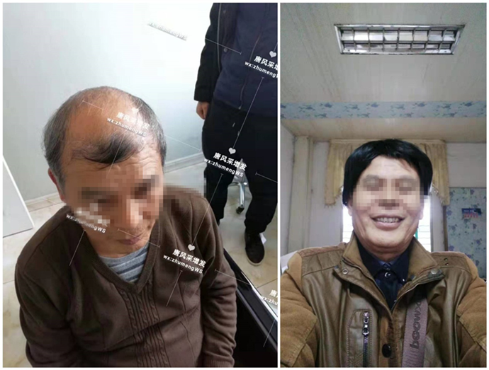 男士假發(fā)發(fā)塊 \