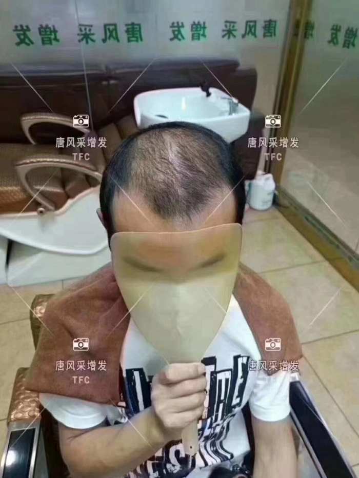男士假發(fā)怎么打理 \
