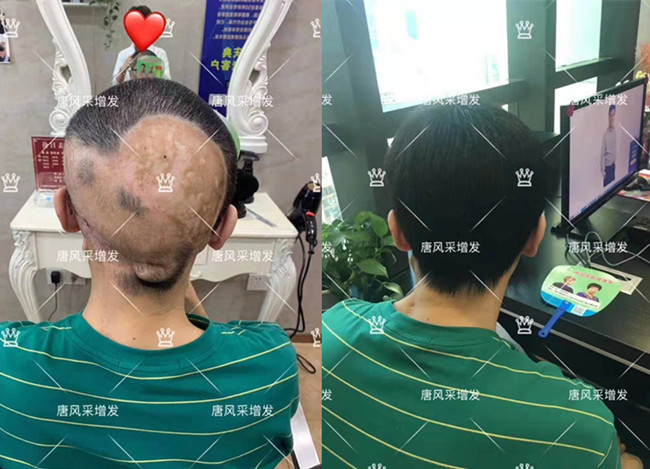 光頭男士可以帶頭套嗎 \