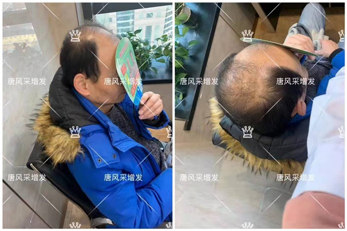 現(xiàn)在戴假發(fā)的人多嗎 \