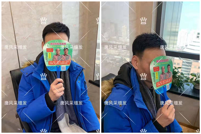 戴假發(fā)的人多嗎 \