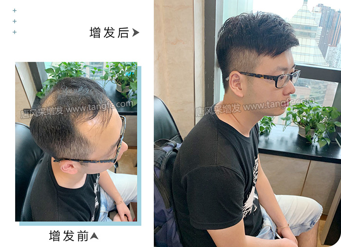 一次自然補(bǔ)發(fā)能用多久 \