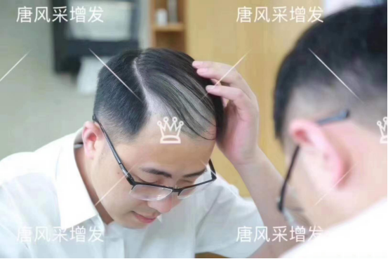 隱形假發(fā) \