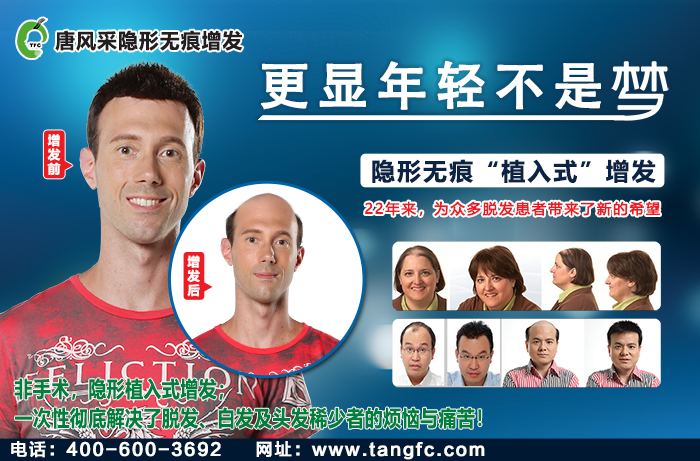 隱形假發(fā) \