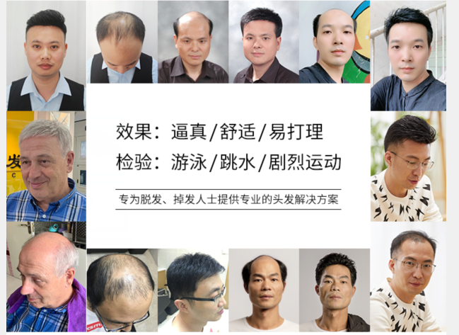 假發(fā)片頭頂補發(fā)片 \