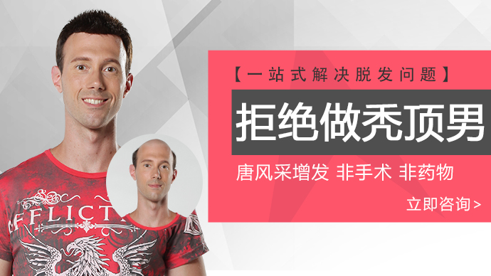 頭頂補發(fā)片 \