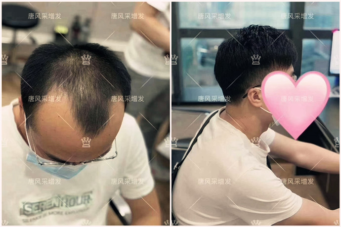 假發(fā)什么品牌好 \