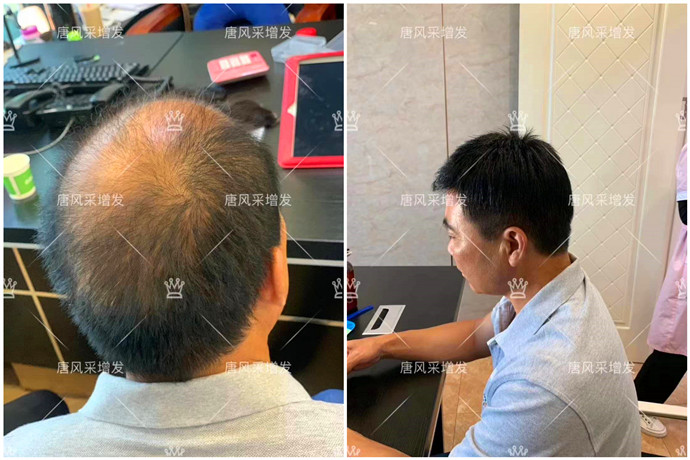 補發(fā)增發(fā) \