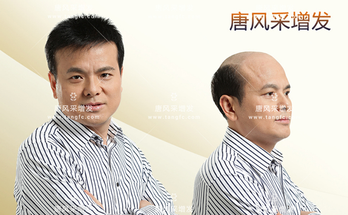 隱形假發(fā) \