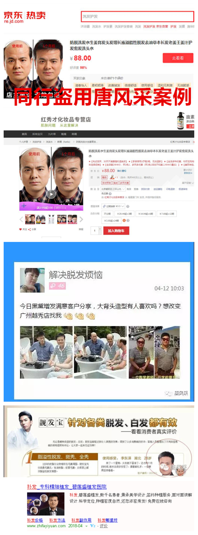 頭發(fā)少做織發(fā)補(bǔ)發(fā) \