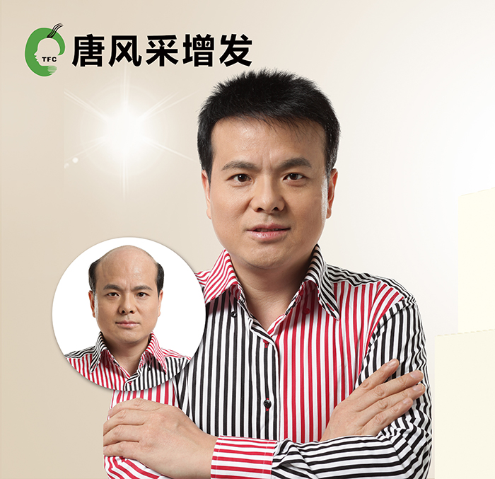 頭發(fā)少做織發(fā)補(bǔ)發(fā) \