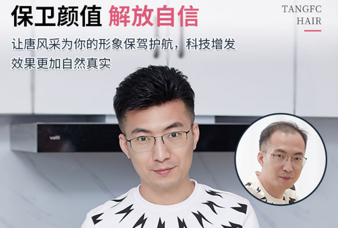 頭發(fā)少做織發(fā)補(bǔ)發(fā) \