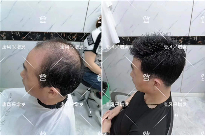 男士假發(fā)會(huì)掉嗎 \