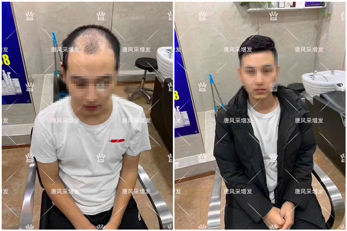 隱形增發(fā) \