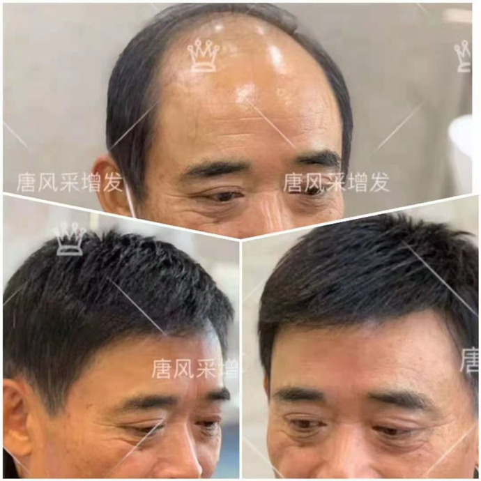 假發(fā)圖片 \