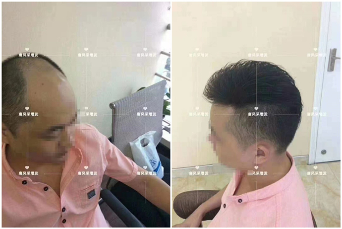 男士高級假發(fā) \