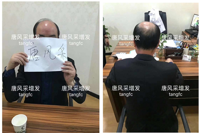 假發(fā)套一般價格多少錢 \