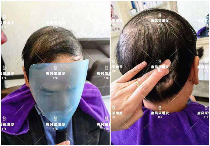 買男士假發(fā) \