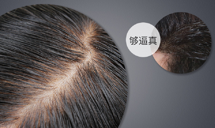 禿頂如何增發(fā) \