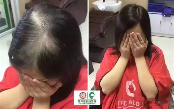 假發(fā)片看得出來(lái)嗎 \