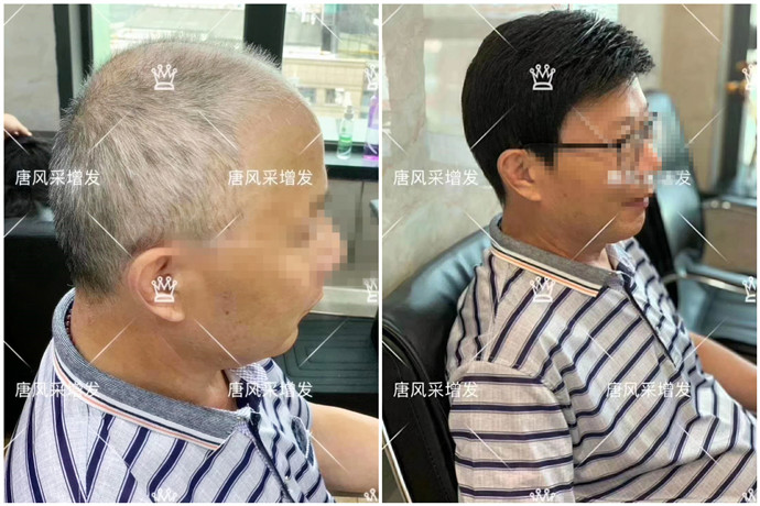 男士短假發(fā)價(jià)格 \