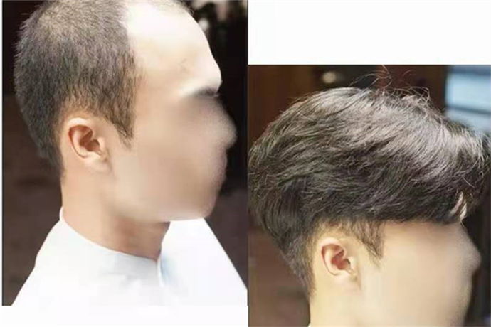 光明頂 \
