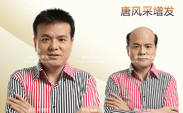 平頭的假發(fā) \