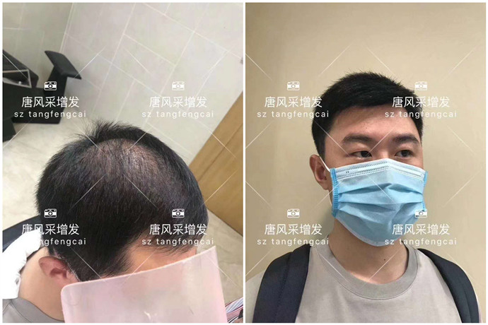 假發(fā)什么牌子好 \