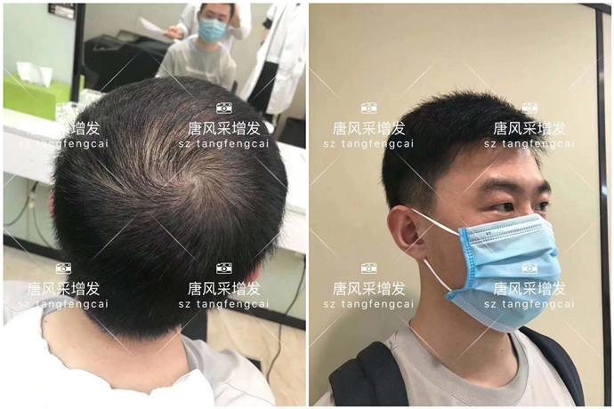 定制假發(fā) \