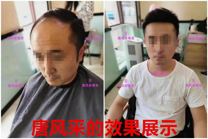 仿真男士假發(fā) \